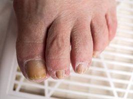 ingrown toenail removal near me services